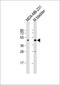 Wnt Family Member 4 antibody, GTX81775, GeneTex, Western Blot image 