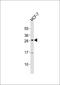 MHC Class I Polypeptide-Related Sequence B antibody, orb1241, Biorbyt, Western Blot image 