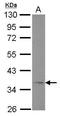 Adiponectin Receptor 1 antibody, GTX104770, GeneTex, Western Blot image 
