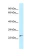 Kazrin, Periplakin Interacting Protein antibody, orb326411, Biorbyt, Western Blot image 