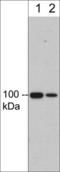 Integrin Subunit Beta 3 antibody, IM5811, ECM Biosciences, Western Blot image 