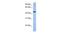 Zinc Finger Protein 766 antibody, PA5-43555, Invitrogen Antibodies, Western Blot image 