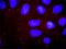 Phosphoinositide-3-Kinase Regulatory Subunit 1 antibody, H00005295-M01, Novus Biologicals, Proximity Ligation Assay image 