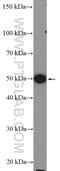 COP9 Signalosome Subunit 2 antibody, 10969-2-AP, Proteintech Group, Western Blot image 