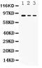 Ataxin 1 antibody, PA5-78844, Invitrogen Antibodies, Western Blot image 