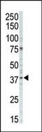 Casein Kinase 1 Alpha 1 antibody, 62-883, ProSci, Western Blot image 