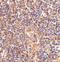 ATM Serine/Threonine Kinase antibody, A00014, Boster Biological Technology, Immunohistochemistry paraffin image 