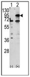 Choline Kinase Beta antibody, AP12255PU-N, Origene, Western Blot image 