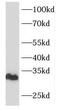 Four And A Half LIM Domains 1 antibody, FNab03110, FineTest, Western Blot image 