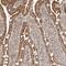 NADH:Ubiquinone Oxidoreductase Subunit B11 antibody, NBP1-83956, Novus Biologicals, Immunohistochemistry frozen image 