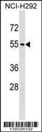 Neuropeptide Y Receptor Y1 antibody, 60-137, ProSci, Western Blot image 