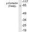 Cortactin antibody, LS-C291493, Lifespan Biosciences, Western Blot image 