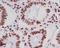 Histone Cluster 4 H4 antibody, M14495-4, Boster Biological Technology, Immunohistochemistry paraffin image 