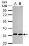Cell Division Cycle 34 antibody, GTX70125, GeneTex, Western Blot image 
