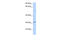 Abhydrolase Domain Containing 17B antibody, 27-098, ProSci, Enzyme Linked Immunosorbent Assay image 