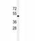 Vascular Endothelial Growth Factor C antibody, F53534-0.1ML, NSJ Bioreagents, Western Blot image 