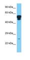 NOP10 Ribonucleoprotein antibody, orb326179, Biorbyt, Western Blot image 