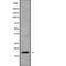 NADH:Ubiquinone Oxidoreductase Subunit A6 antibody, abx217086, Abbexa, Western Blot image 