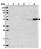 LPLA2 antibody, NBP1-92089, Novus Biologicals, Western Blot image 