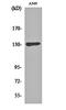 Paired amphipathic helix protein Sin3b antibody, orb161854, Biorbyt, Western Blot image 