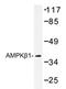 Protein Kinase AMP-Activated Non-Catalytic Subunit Beta 1 antibody, AP20343PU-N, Origene, Western Blot image 
