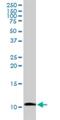 Islet Amyloid Polypeptide antibody, H00003375-D01P, Novus Biologicals, Western Blot image 