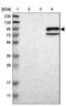 Protocadherin Beta 5 antibody, NBP1-84144, Novus Biologicals, Western Blot image 