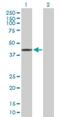 TRNA Methyltransferase 9B (Putative) antibody, H00057604-B01P, Novus Biologicals, Western Blot image 