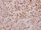 DnaJ Heat Shock Protein Family (Hsp40) Member B4 antibody, A06835, Boster Biological Technology, Immunohistochemistry paraffin image 