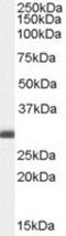 B Cell Receptor Associated Protein 31 antibody, NB100-1016, Novus Biologicals, Western Blot image 