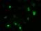 Zinc Finger Imprinted 2 antibody, NBP2-03325, Novus Biologicals, Immunofluorescence image 
