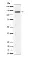 Cadherin 4 antibody, M07632-1, Boster Biological Technology, Western Blot image 