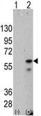 Serine/threonine-protein kinase PINK1, mitochondrial antibody, ab75487, Abcam, Western Blot image 