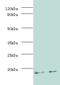 MTB MPT63 antibody, LS-C318194, Lifespan Biosciences, Western Blot image 