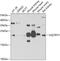 Ubiquinol-Cytochrome C Reductase, Rieske Iron-Sulfur Polypeptide 1 antibody, GTX33574, GeneTex, Western Blot image 