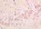 Solute Carrier Family 12 Member 5 antibody, orb2808, Biorbyt, Immunohistochemistry paraffin image 