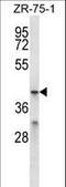Major Facilitator Superfamily Domain Containing 2B antibody, LS-C164168, Lifespan Biosciences, Western Blot image 