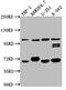 Toll Like Receptor 5 antibody, CSB-RA545516A0HU, Cusabio, Western Blot image 