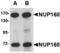 Nucleoporin 160 antibody, A05629-1, Boster Biological Technology, Western Blot image 