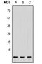 PAGE Family Member 3 antibody, GTX56112, GeneTex, Western Blot image 