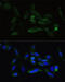 Transforming Growth Factor Beta Receptor 2 antibody, 14-143, ProSci, Immunofluorescence image 