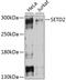 SET Domain Containing 2, Histone Lysine Methyltransferase antibody, GTX64430, GeneTex, Western Blot image 