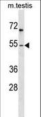 Forkhead box protein F1 antibody, LS-C159673, Lifespan Biosciences, Western Blot image 