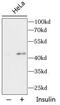 AKT1 Substrate 1 antibody, FNab09943, FineTest, Western Blot image 