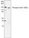 MAP3K5 antibody, MA5-28020, Invitrogen Antibodies, Western Blot image 