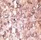 Autophagy Related 5 antibody, LS-C156610, Lifespan Biosciences, Immunohistochemistry paraffin image 