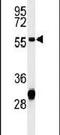 Hydroxyacyl-CoA Dehydrogenase Trifunctional Multienzyme Complex Subunit Beta antibody, PA5-26858, Invitrogen Antibodies, Western Blot image 