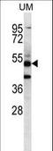 Pancreatic Lipase Related Protein 3 antibody, LS-C163819, Lifespan Biosciences, Western Blot image 