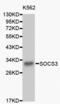 Suppressor Of Cytokine Signaling 3 antibody, LS-C331075, Lifespan Biosciences, Western Blot image 
