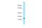 Testis-specific basic protein Y 1 antibody, A16755, Boster Biological Technology, Western Blot image 